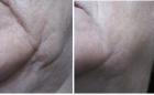 Anti-Aging war gestern Re-Aging ist der Trend